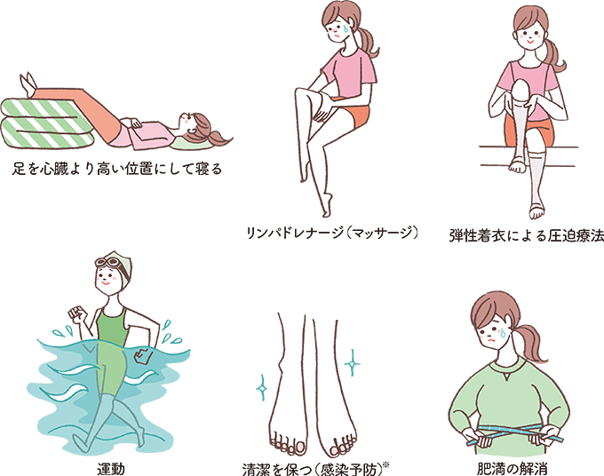 リンパ浮腫の対処法をイラストで解説。足を心臓より高い位置にして寝る、リンパドレナージ（マッサージ）、弾性着衣による圧迫療法、運動、清潔を保つ（感染予防）、肥満の解消
