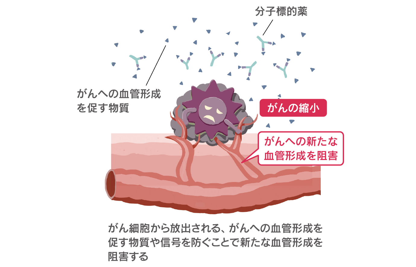 分子標的薬はがん細胞から放出される、がんへの血管形成を促す物質や信号を防ぐことで新たな血管形成を阻害する