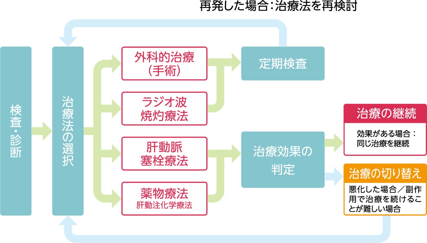 検査・診断から治療法の選択、治療効果の判定を行うまでの肝がんの治療の流れ