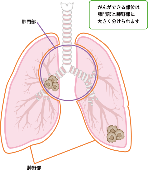 肺門部と肺野部の位置関係を示した図。がんができる部位は肺門部と肺野部に大きく分けられる。