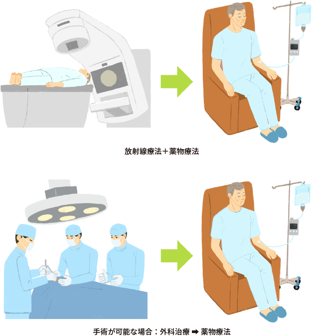 外科治療と術後の薬物療法、または薬物療法と放射線療法を組み合わせた治療法のイメージイラスト