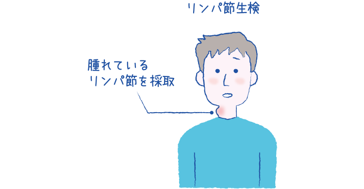 喫煙はNHLを悪化させますか?